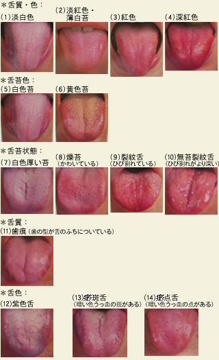 写真：舌の色